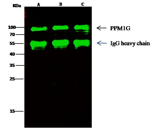 PPM1G Antibody in Immunoprecipitation (IP)