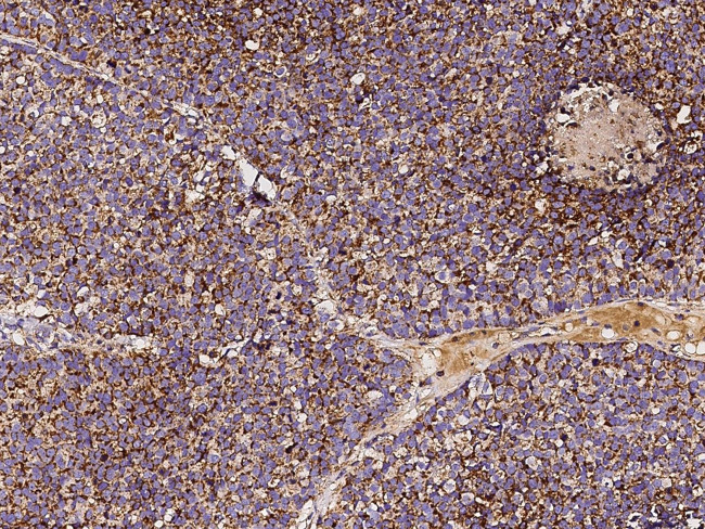 SOD2 Antibody in Immunohistochemistry (Paraffin) (IHC (P))