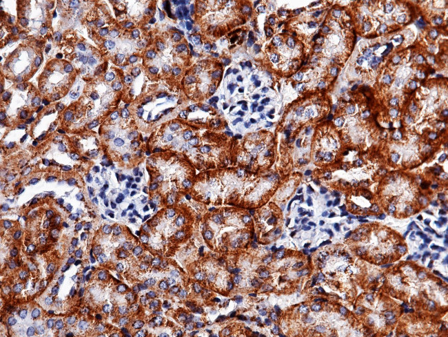 Carbonic Anhydrase XII Antibody in Immunohistochemistry (Paraffin) (IHC (P))