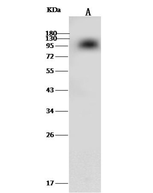 Prothrombin Antibody in Western Blot (WB)