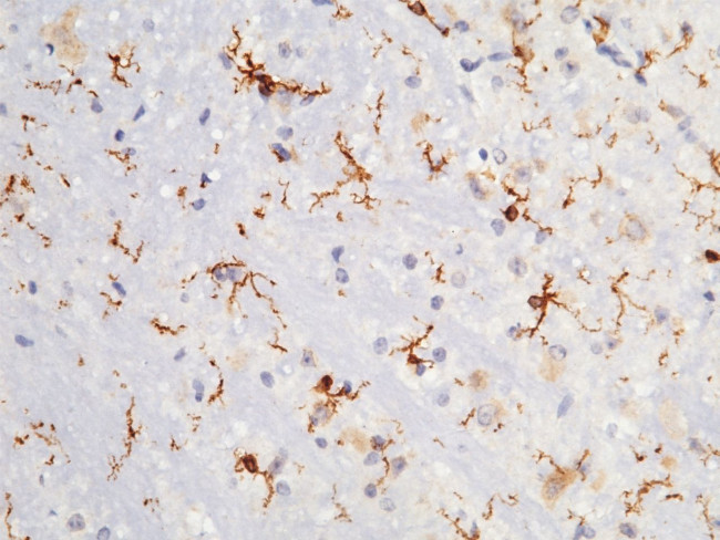 CD64 Antibody in Immunohistochemistry (Paraffin) (IHC (P))