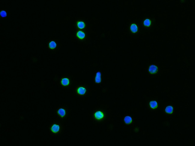 IFNGR1 Antibody in Immunocytochemistry (ICC/IF)