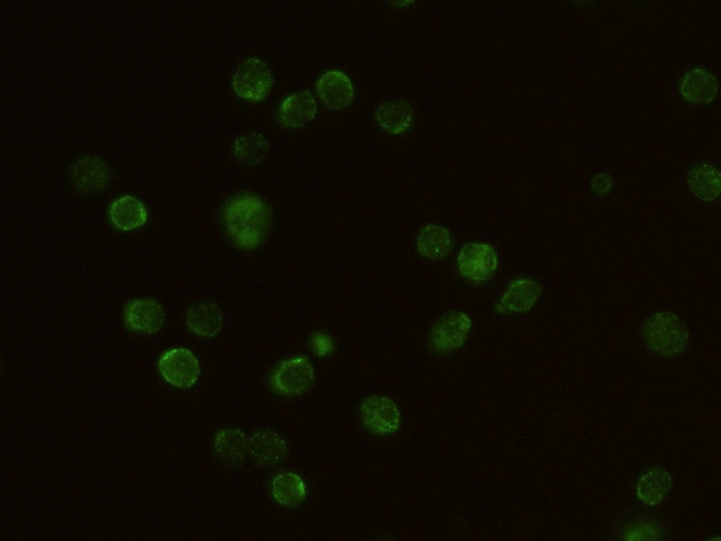 IL2RG Antibody in Immunocytochemistry (ICC/IF)