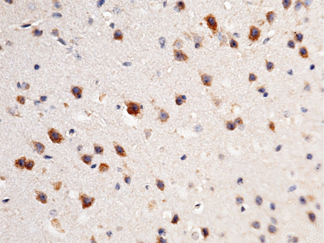 UCHL3 Antibody in Immunohistochemistry (Paraffin) (IHC (P))