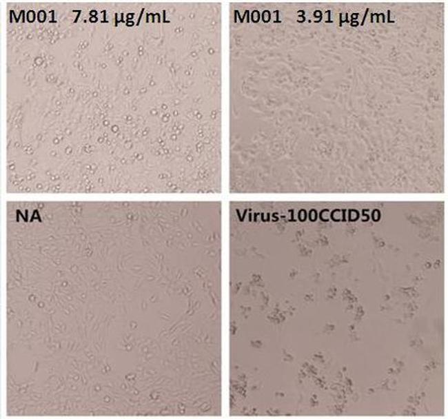 Enterovirus 71 VP4 Antibody in Neutralization (Neu)