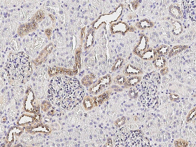 CX3CL1 Antibody in Immunohistochemistry (Paraffin) (IHC (P))