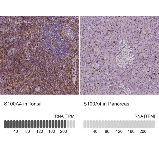 S100A4 Antibody