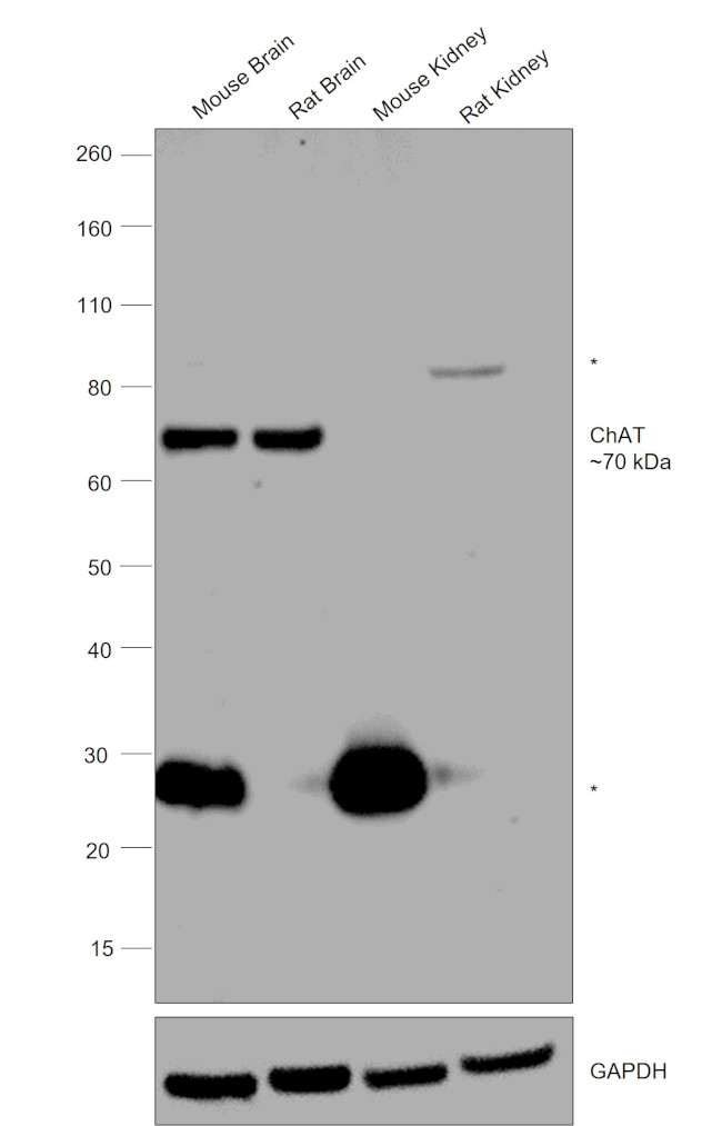 ChAT Antibody in Western Blot (WB)