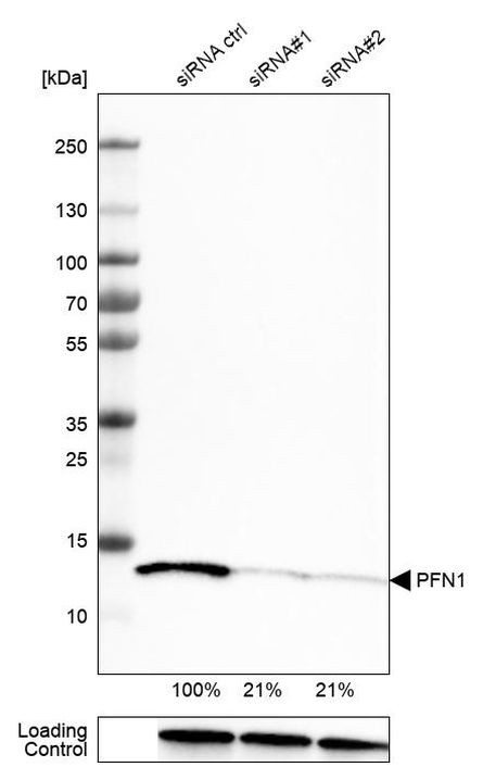 Profilin 1 Antibody