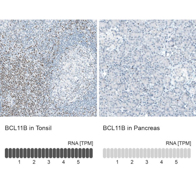 BCL11B Antibody