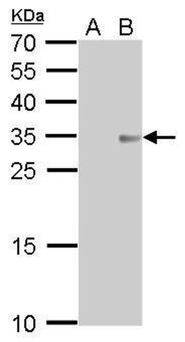 COL11A2 Antibody in Western Blot (WB)