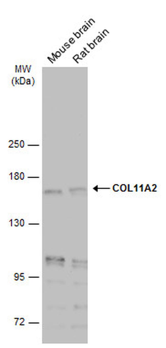 COL11A2 Antibody in Western Blot (WB)