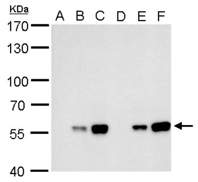 Carbonic Anhydrase IX Antibody in Western Blot (WB)