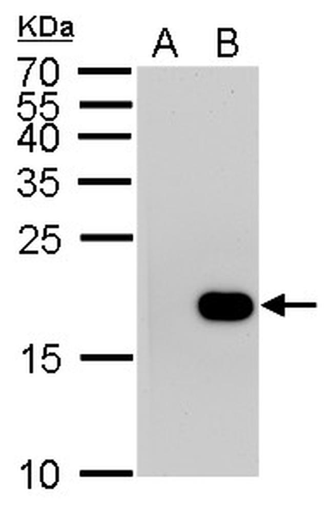 Phospho-Histone H3 (Ser10) Antibody in Western Blot (WB)