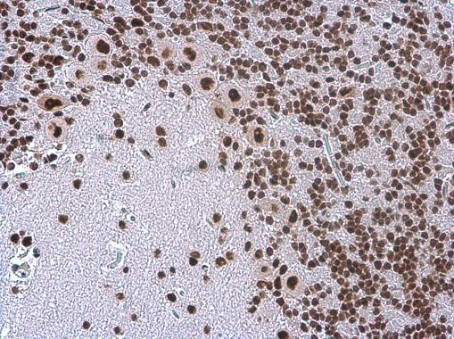 TDP-43 Antibody in Immunohistochemistry (Paraffin) (IHC (P))