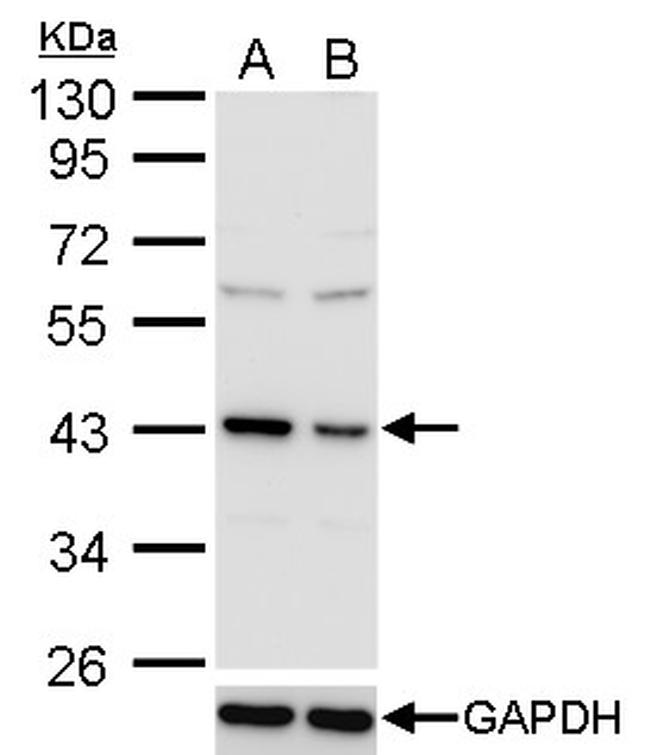 TDP-43 Antibody in Western Blot (WB)