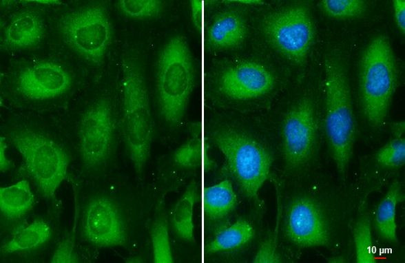 MEK2 Antibody in Immunocytochemistry (ICC/IF)