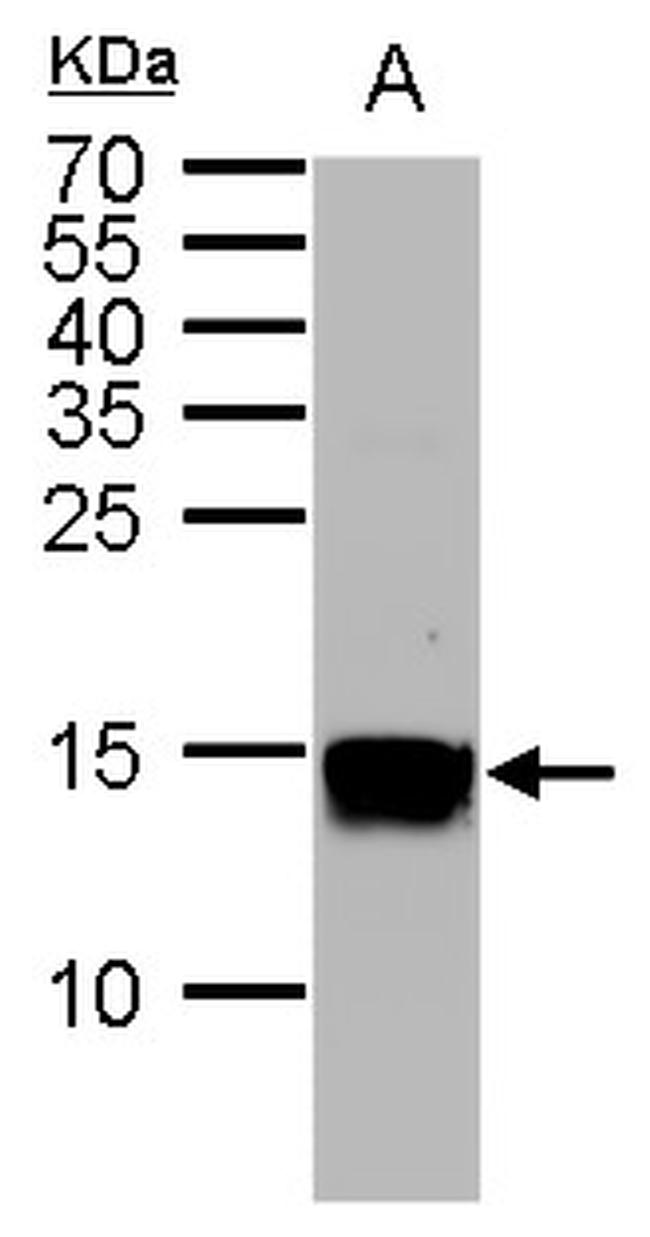 H3K36me2 Antibody in Western Blot (WB)