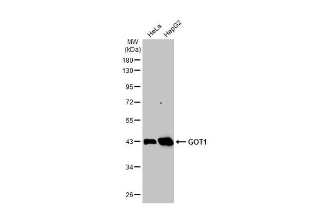 GOT1 Antibody in Western Blot (WB)