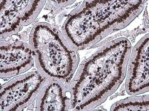 H3K27ac Antibody in Immunohistochemistry (Paraffin) (IHC (P))