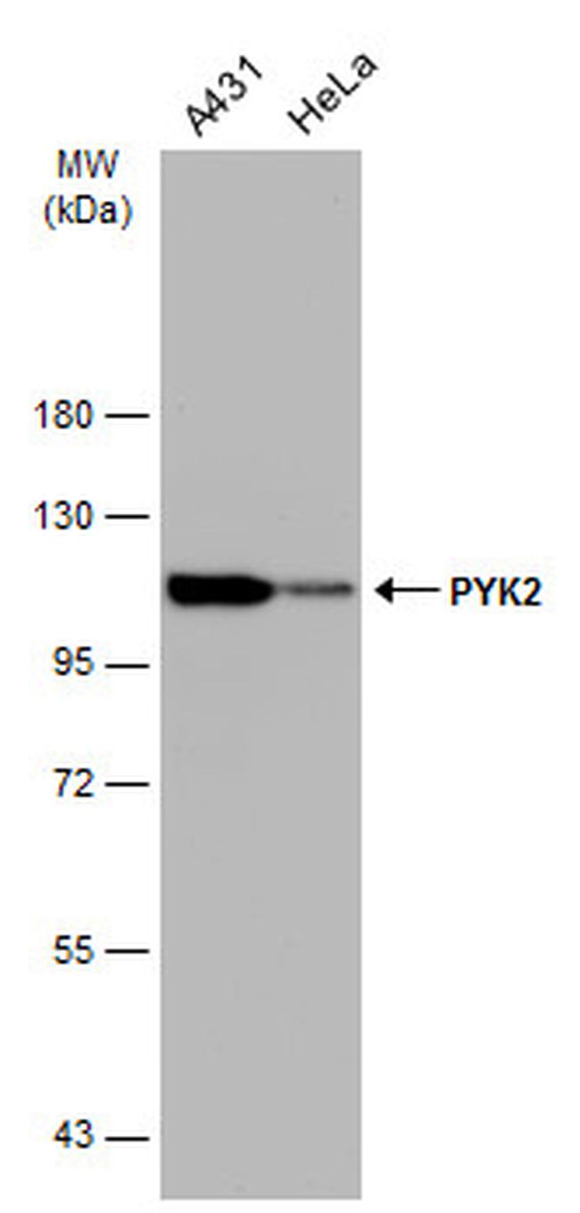 PYK2 Antibody in Western Blot (WB)