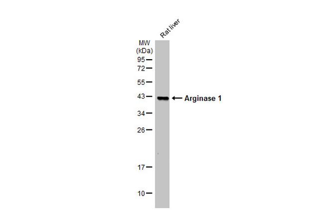 Arginase 1 Monoclonal Antibody (GT5811) (MA5-31577)