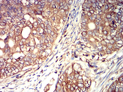 Arp3 Antibody in Immunohistochemistry (Paraffin) (IHC (P))