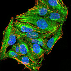 ATG13 Antibody in Immunocytochemistry (ICC/IF)