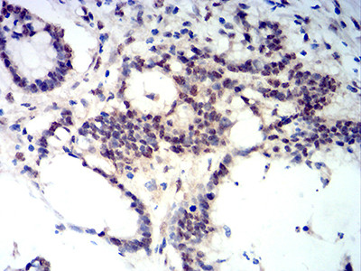 BCL11B Antibody in Immunohistochemistry (Paraffin) (IHC (P))