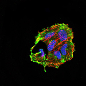 CIDEC Antibody in Immunocytochemistry (ICC/IF)