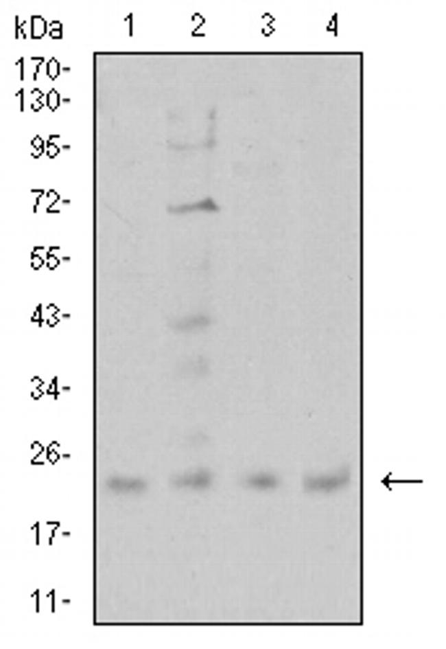 CIRBP Antibody in Western Blot (WB)
