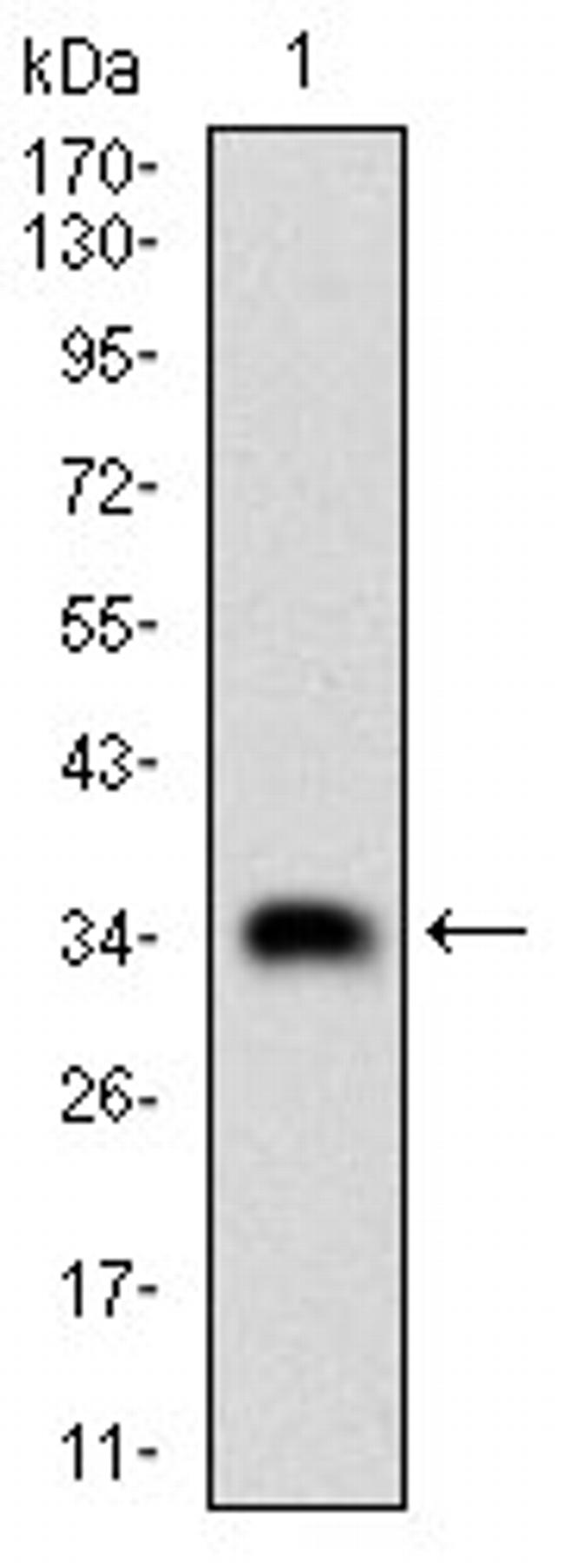 CK2 beta Antibody in Western Blot (WB)