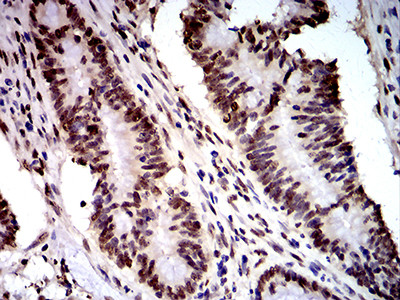 DDX1 Antibody in Immunohistochemistry (Paraffin) (IHC (P))