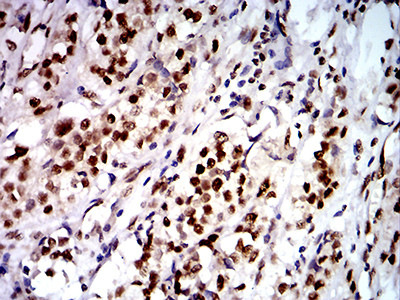 DDX1 Antibody in Immunohistochemistry (Paraffin) (IHC (P))