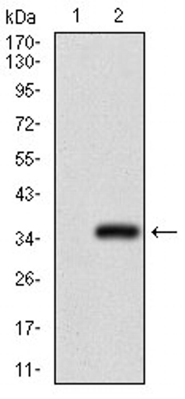 GSC Antibody in Western Blot (WB)