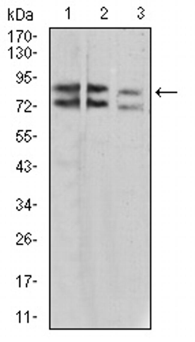 IL1RAPL1 Antibody in Western Blot (WB)