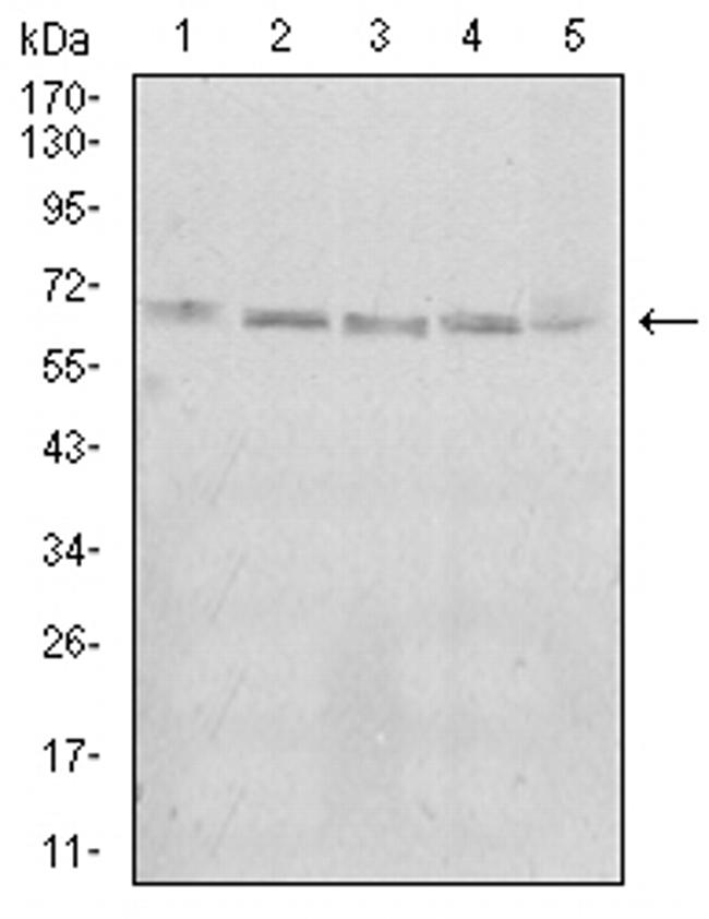 KBTBD8 Antibody in Western Blot (WB)