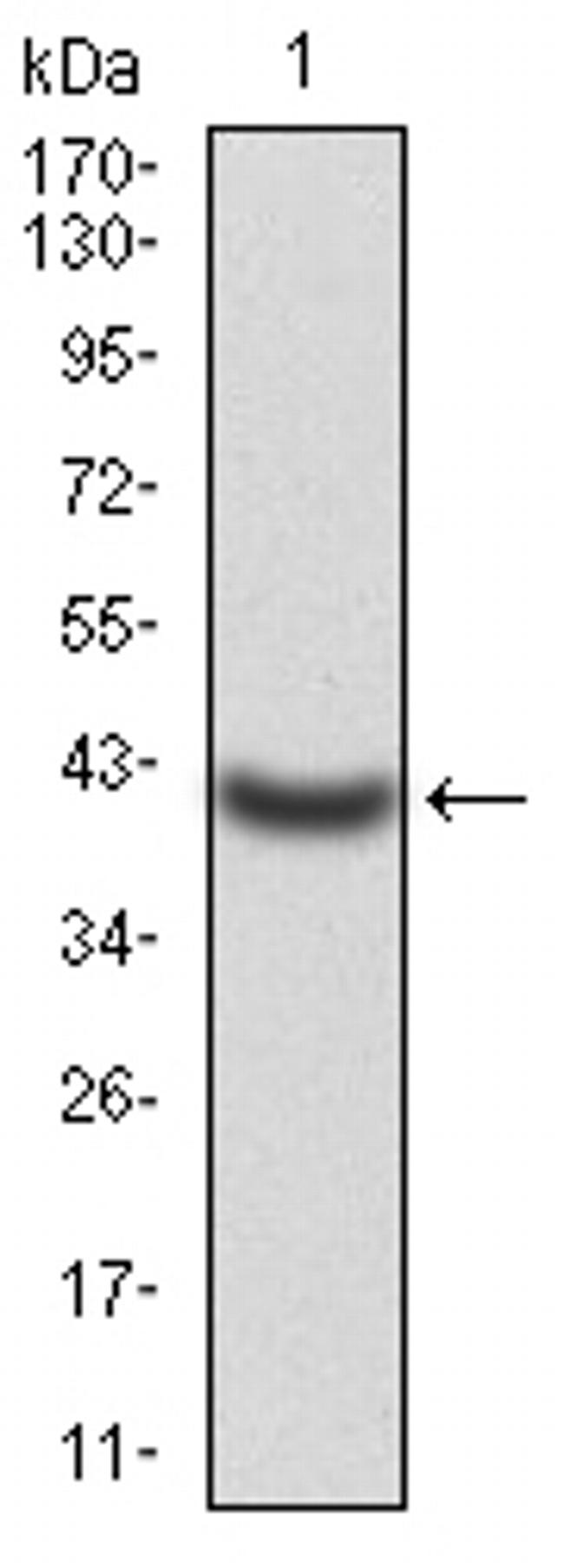 KV4.2 (KCND2) Antibody in Western Blot (WB)