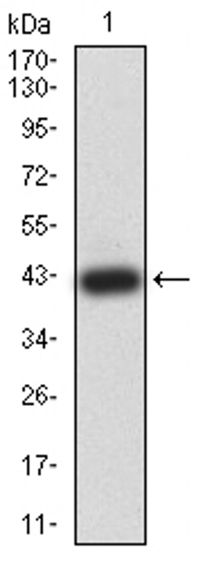 JMJD2B Antibody in Western Blot (WB)