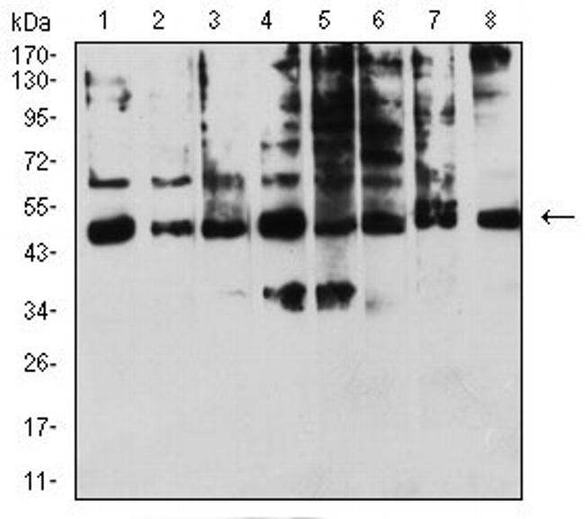 KIR3DL1 Antibody in Western Blot (WB)