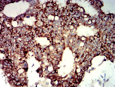 P2Y14 Antibody in Immunohistochemistry (Paraffin) (IHC (P))