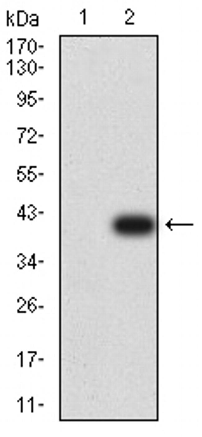 Plexin-A1 Antibody in Western Blot (WB)