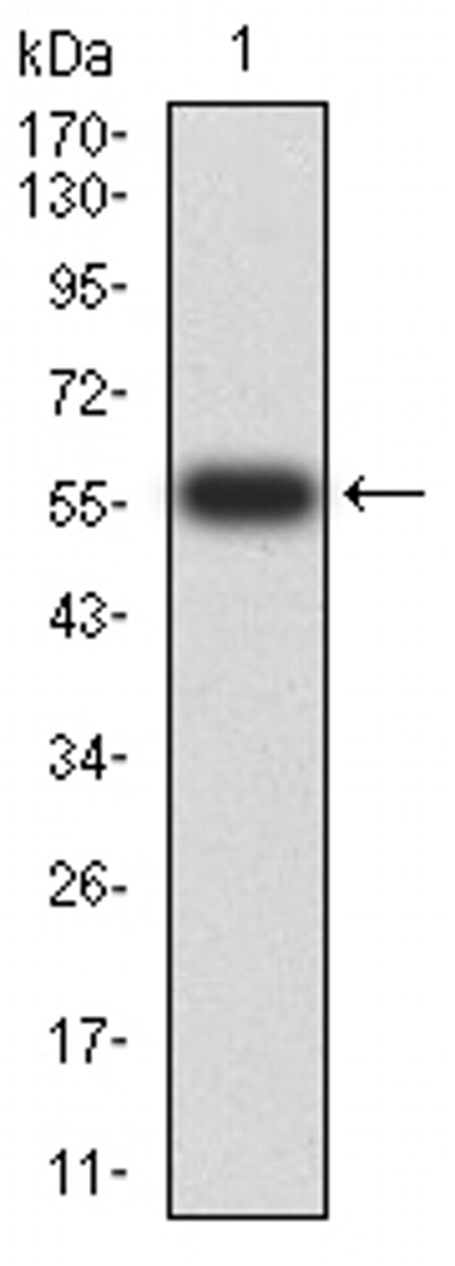 PTPN14 Antibody in Western Blot (WB)
