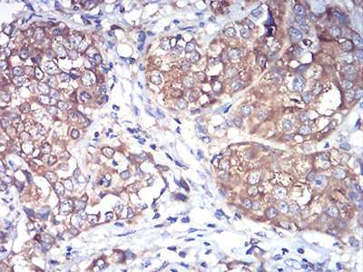 RAB1B Antibody in Immunohistochemistry (Paraffin) (IHC (P))