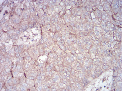 RALA Antibody in Immunohistochemistry (Paraffin) (IHC (P))