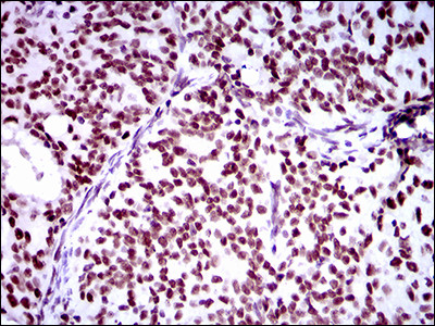 RING1 Antibody in Immunohistochemistry (Paraffin) (IHC (P))