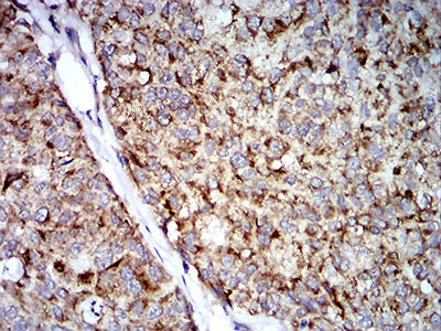 TRIM25 Antibody in Immunohistochemistry (Paraffin) (IHC (P))