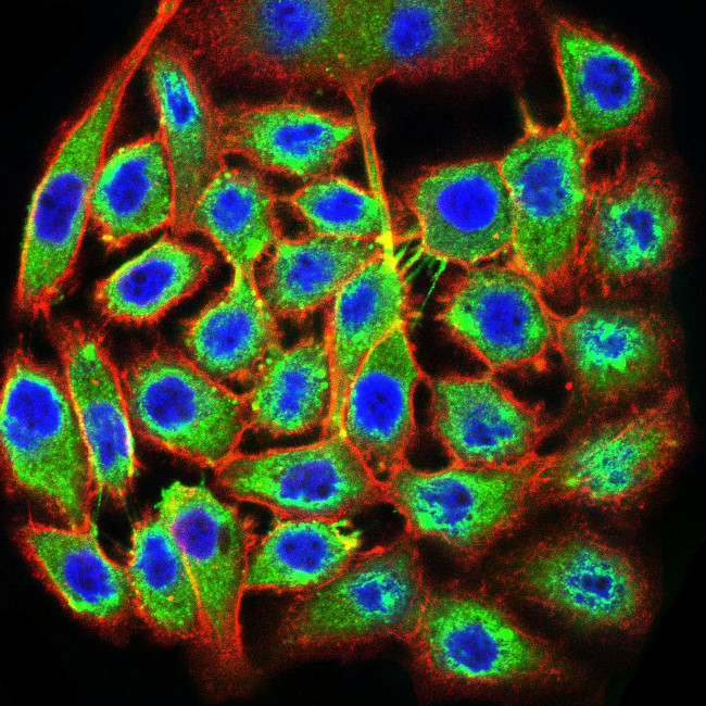 TTF1 Antibody in Immunocytochemistry (ICC/IF)