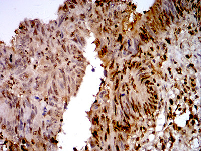 TTF1 Antibody in Immunohistochemistry (Paraffin) (IHC (P))