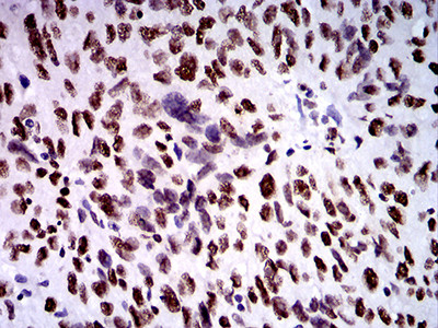 ZFP91 Antibody in Immunohistochemistry (Paraffin) (IHC (P))